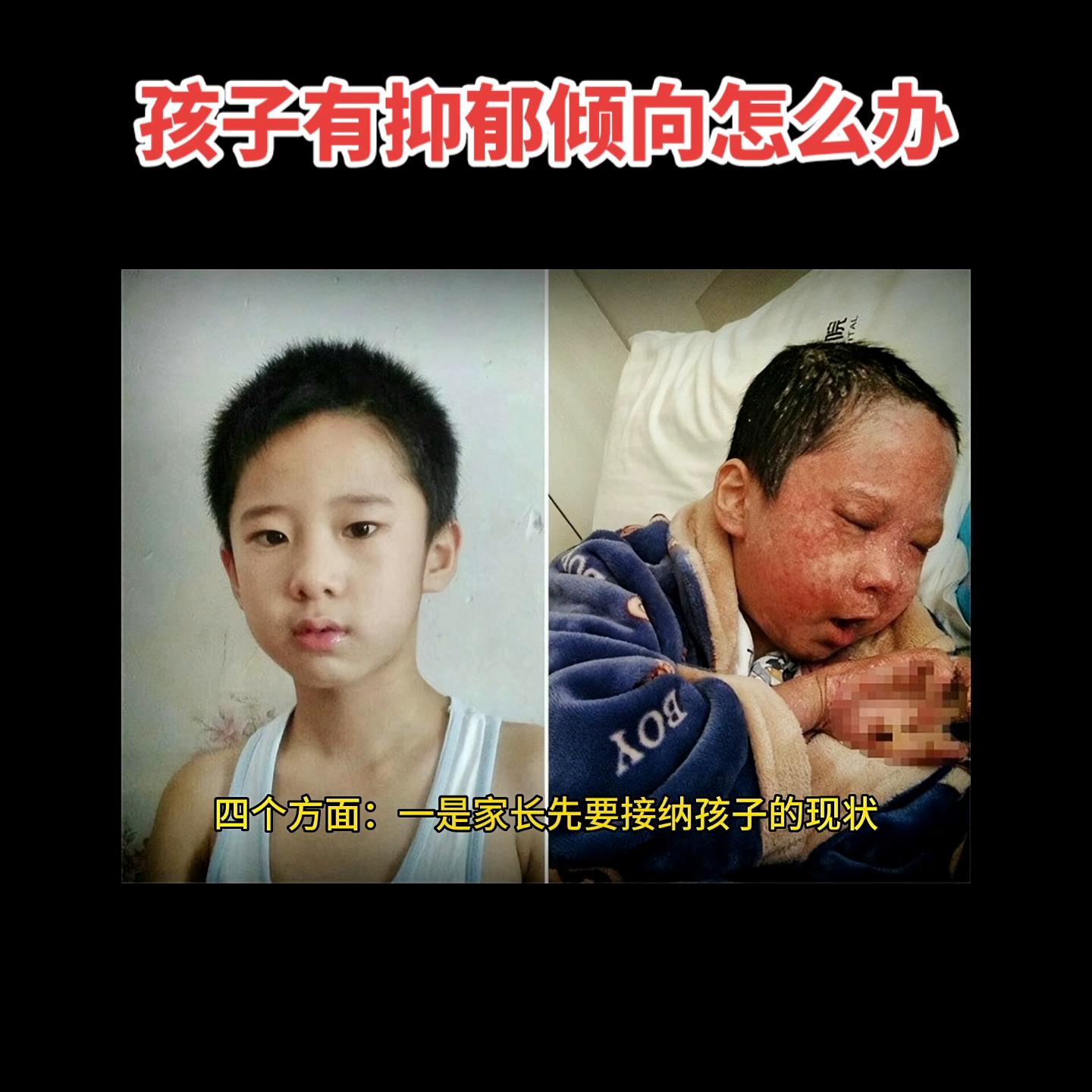 家有抑郁的孩子一定要记住这件事,现在孩子的抑郁症怎么那么多