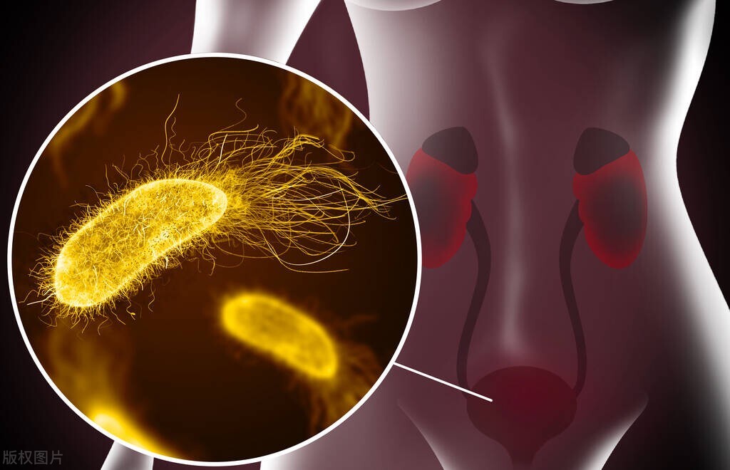 尿路感染什么情况下需要用抗生素,尿路支原体感染抗生素一般用几天