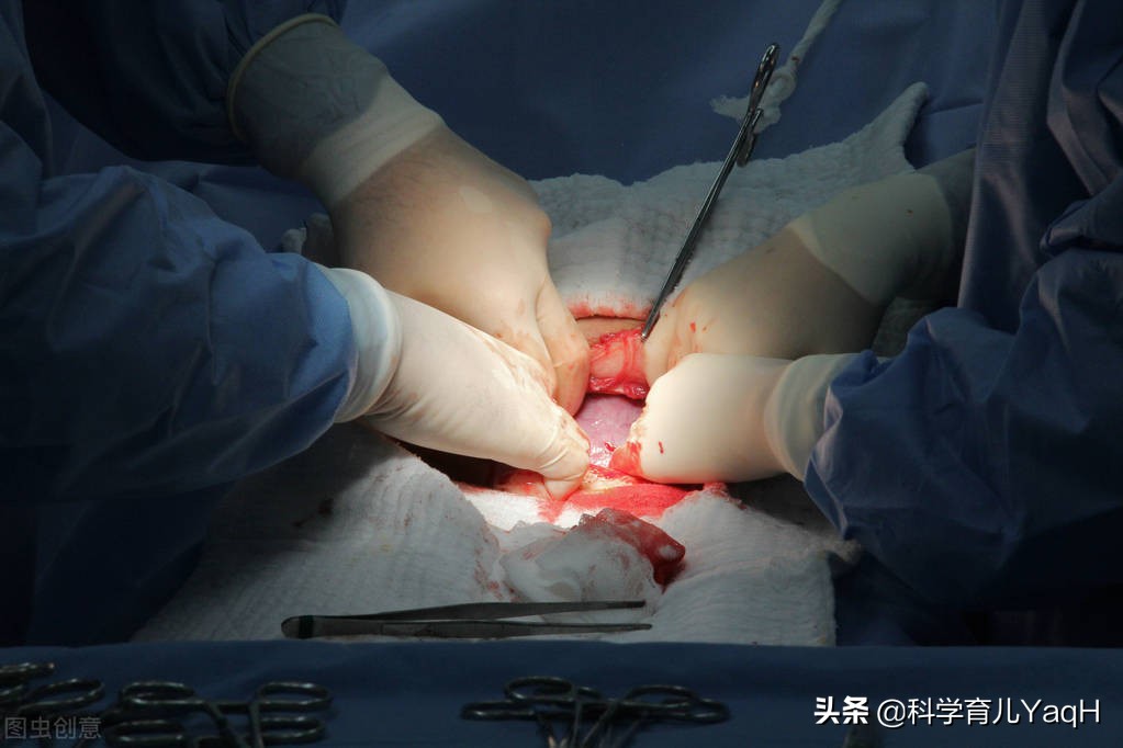 正常分娩产后护理,促进自然分娩的护理金标准