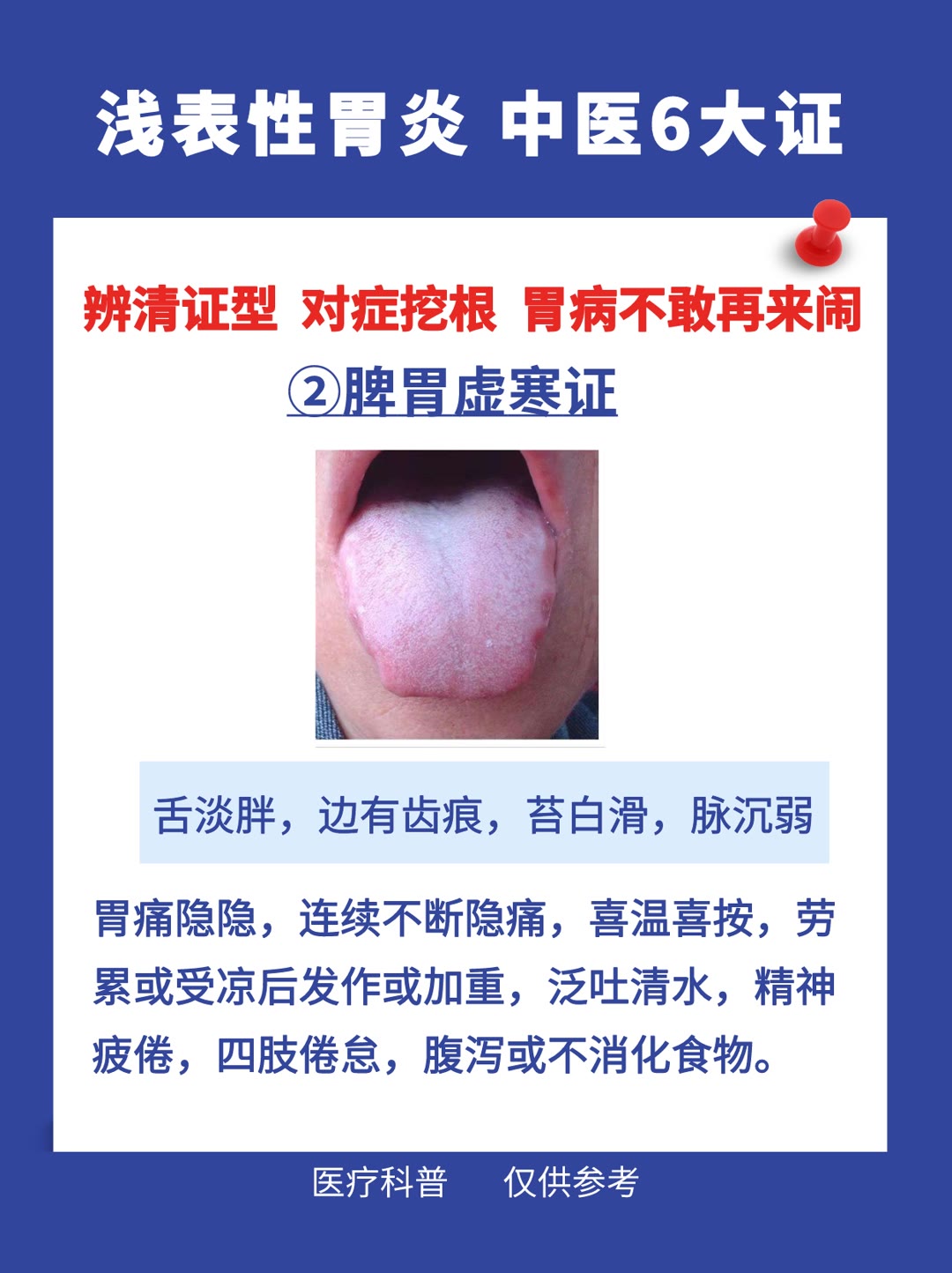 慢性浅表性胃炎中医治疗药方,浅表性胃炎中医判断