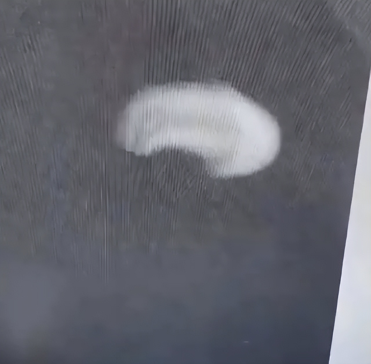 女子摔倒磕掉牙,摔倒的时候牙齿磕到嘴唇怎么处理