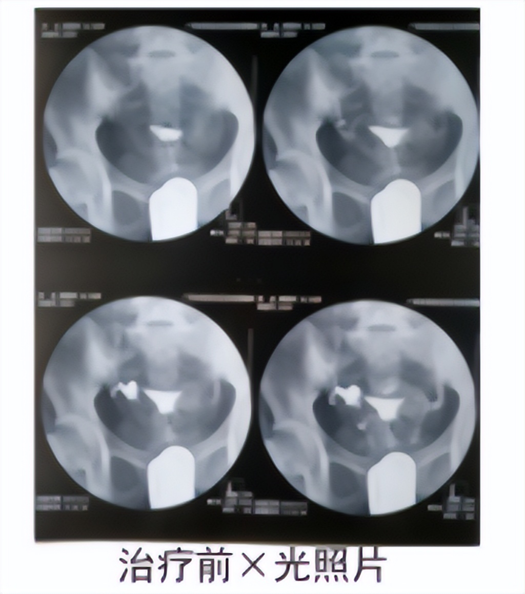 28岁备孕二胎一直不孕是怎么回事,38岁二胎不孕怎么回事