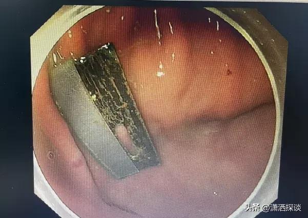 惊呆了，避孕套还能救命？