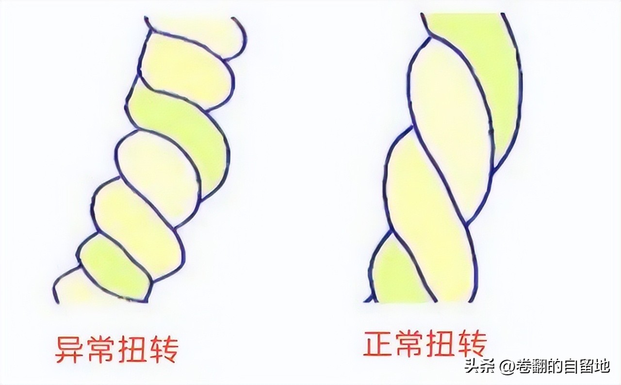 孕晚期宝宝突然不动也没有宫缩,孕晚期宝宝突然不怎么动怎么回事