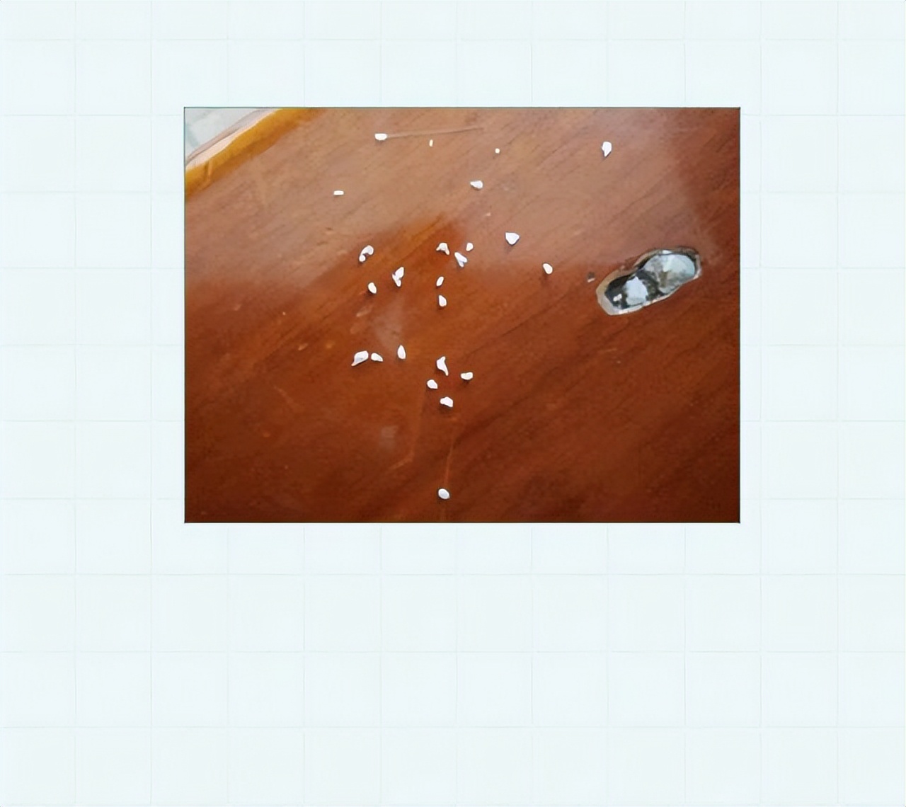 头皮上白色的小颗粒可以抠下来,为什么抓头皮会有白色小颗粒