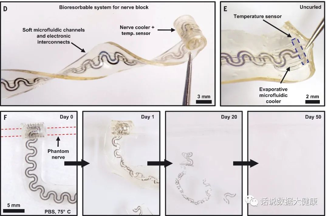 疼痛非药物治疗,疼痛无需再忍受