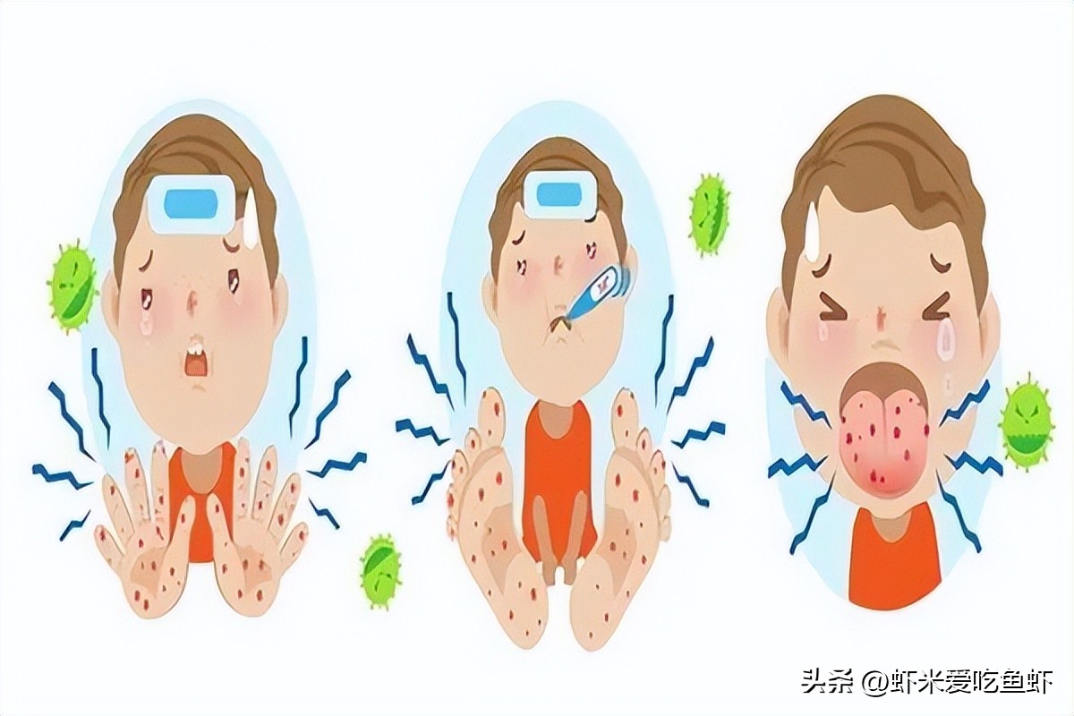 儿童手足口预防喝什么药,幼儿园手足口预防措施有哪些