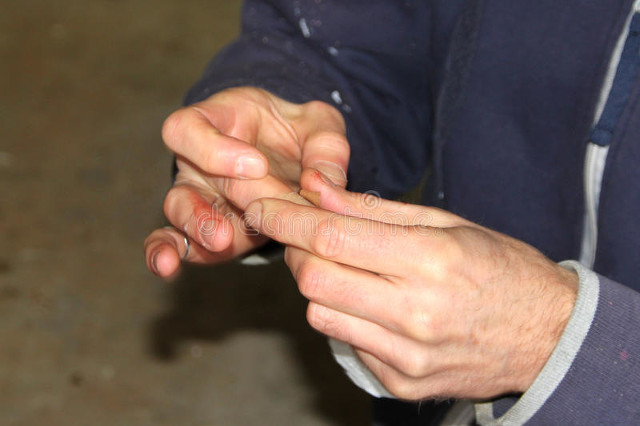 “外阴癌”都是拖出来的？医生：出现3种异常信号，要引起注意