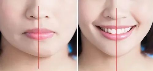 怎样改善左右脸不对称,怎样改善大小脸不对称呢