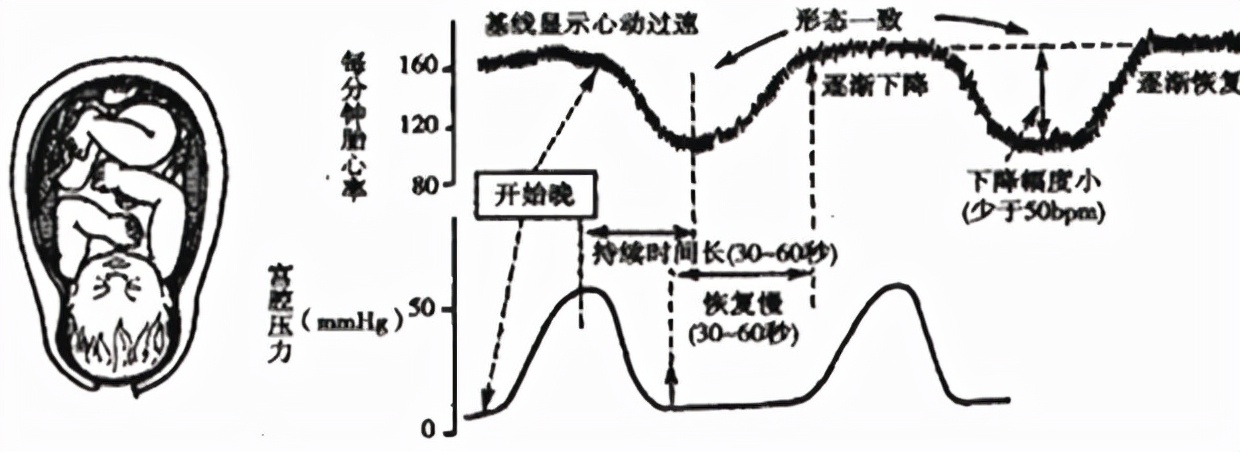 孕妈妈需要经历什么,从怀孕到生需要做多少次产检