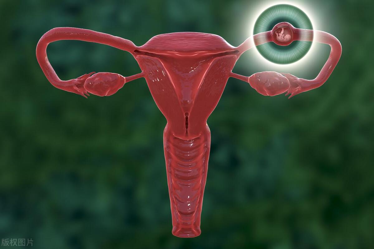 宫颈癌多是“拖”出来的，女人若有3处异常“提示”，别轻易忽视