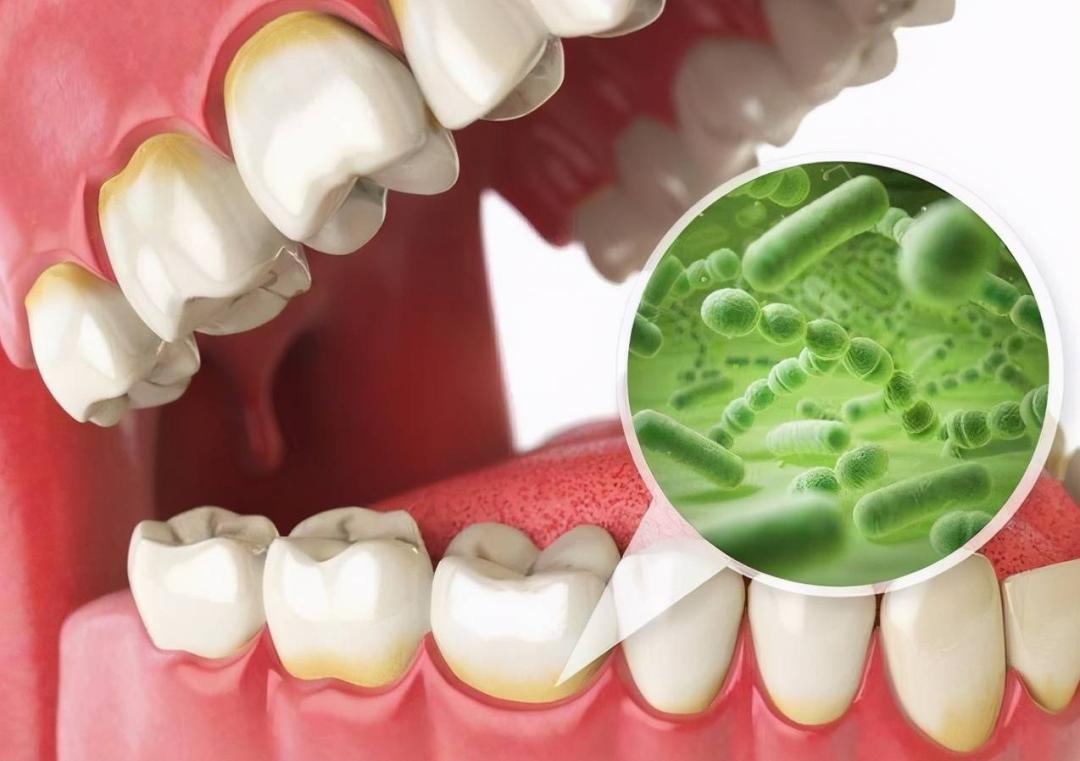 大人口腔细菌会传染宝宝吗,大人口腔多少细菌传染宝宝