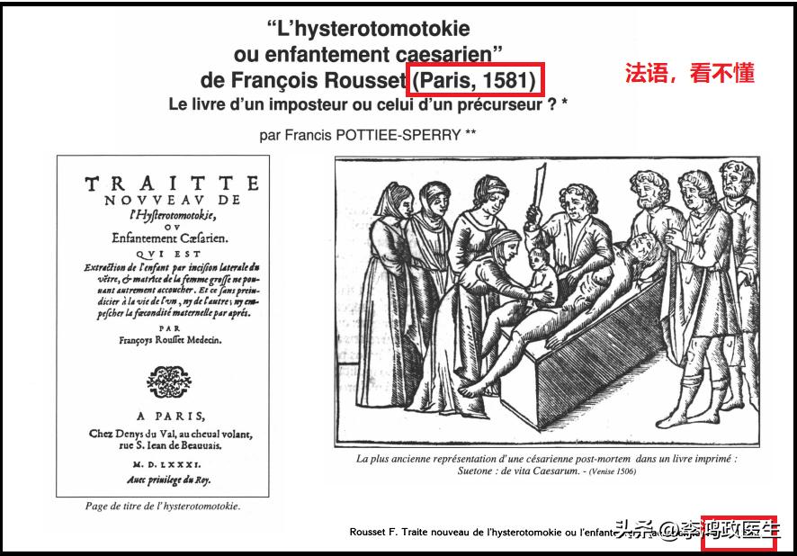 鍓栬吂浜х暀涓嬫墜鏈垁,鍓栬吂浜ч仐鐣欐墜鏈垁