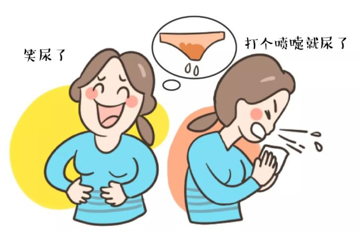 一不能笑，二不能喷嚏，三不能咳嗽？“小吊带”解决女性漏尿尴尬