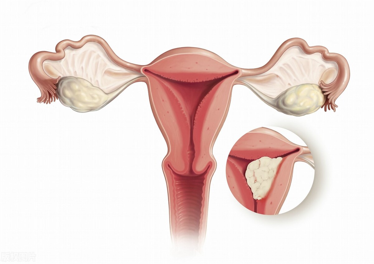 女人老了子宫会掉出来吗,女人老了有的人为什么子宫会脱落