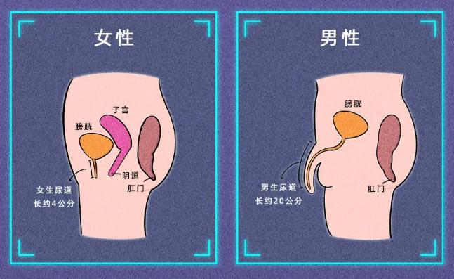 3个方面症状提醒你注意尿路感染,发生院内尿路感染最常见原因