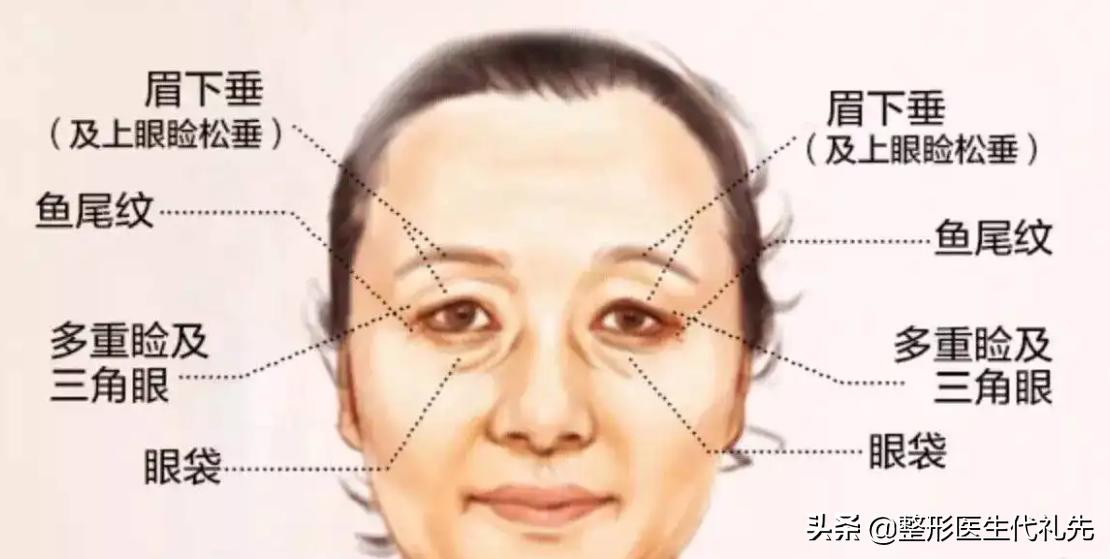 40岁以后为什么眼睛变小了,年轻人眼睛变小了怎么回事