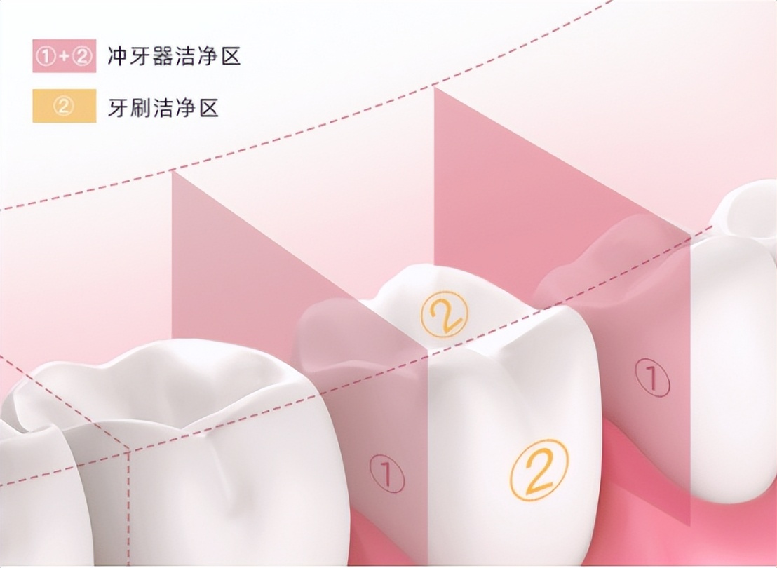 冲牙器测评实验室,冲牙器洁碧拜尔