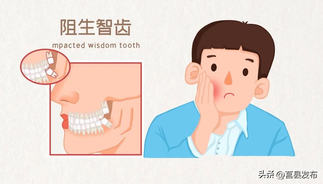 拔完智齿疼一般痛几天能正常吃饭,智齿发炎嗓子痛怎么办咽口水都疼