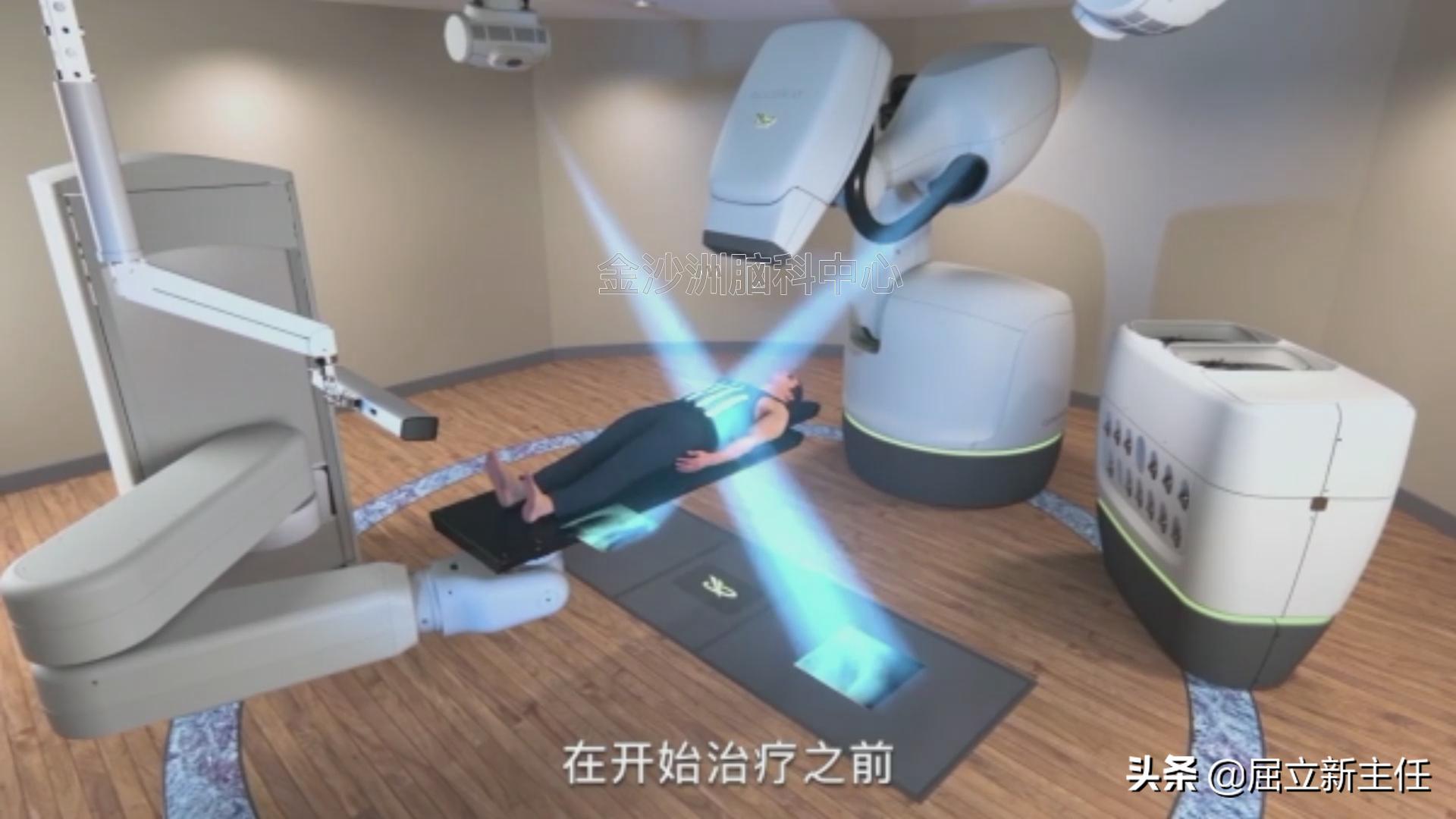 射波刀治疗后多久肿瘤才缩小,做了射波刀后肿瘤变大了