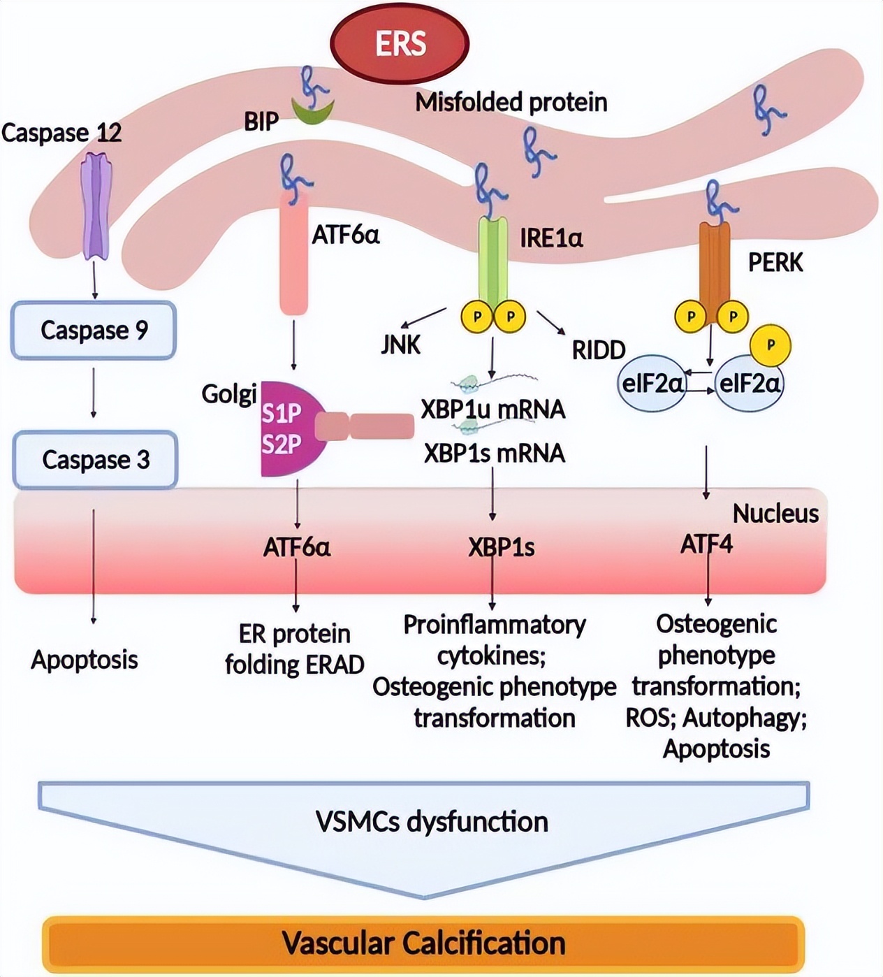 血管钙化的机制是什么,血管钙化如何治疗吃什么中成药