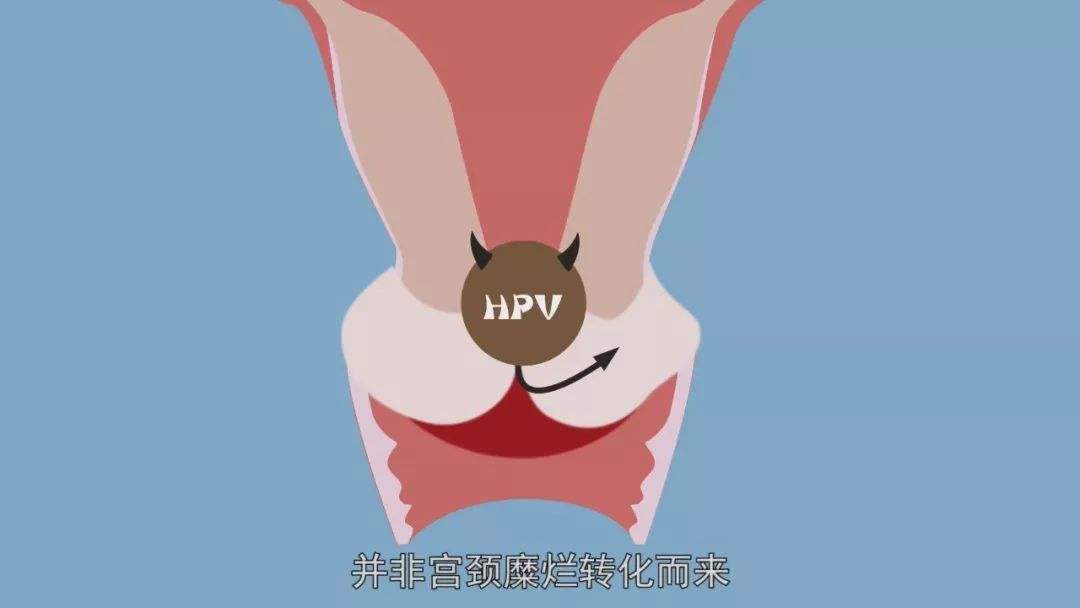 当代怨种——治“宫颈糜烂”花了两万块，真的有必要吗？