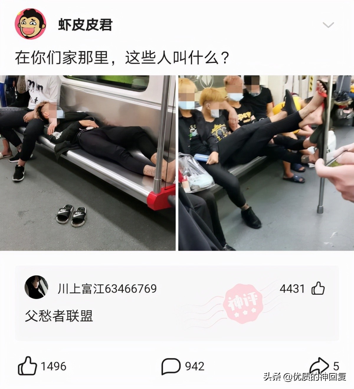 头发洗了一天就很油很痒怎么回事,头发天天洗还是痒得厉害怎么回事