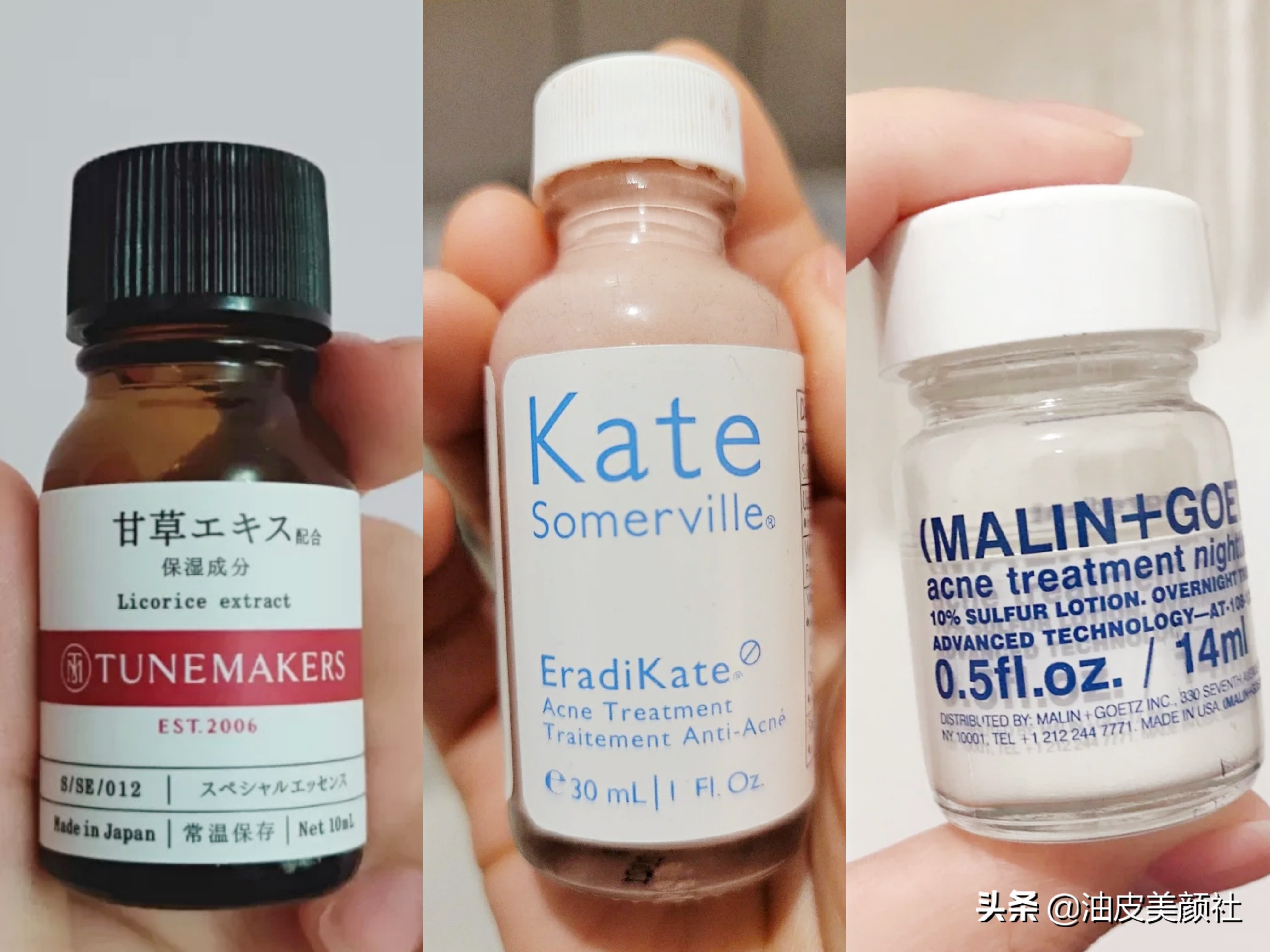 祛痘好物推荐一下,推荐十款实用的祛痘产品