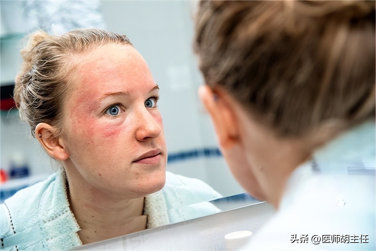 带状疱疹最佳治疗方法,湿疹带状疱疹擦什么好得快