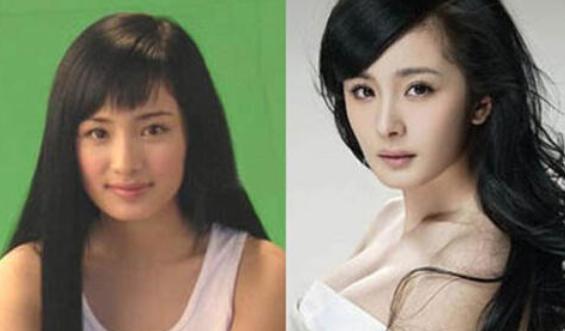 这些整容后都逆袭的女明星,盘点全网那些整容失败的女明星