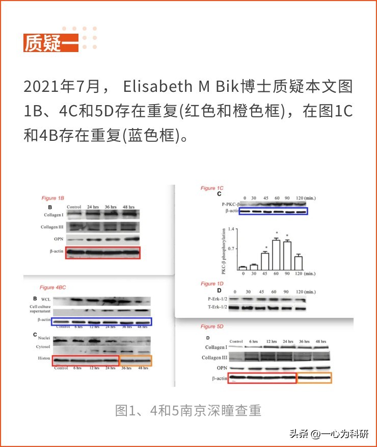 江苏大学附属四院发表的论文因相似的蛋白条带和问题引文被质疑