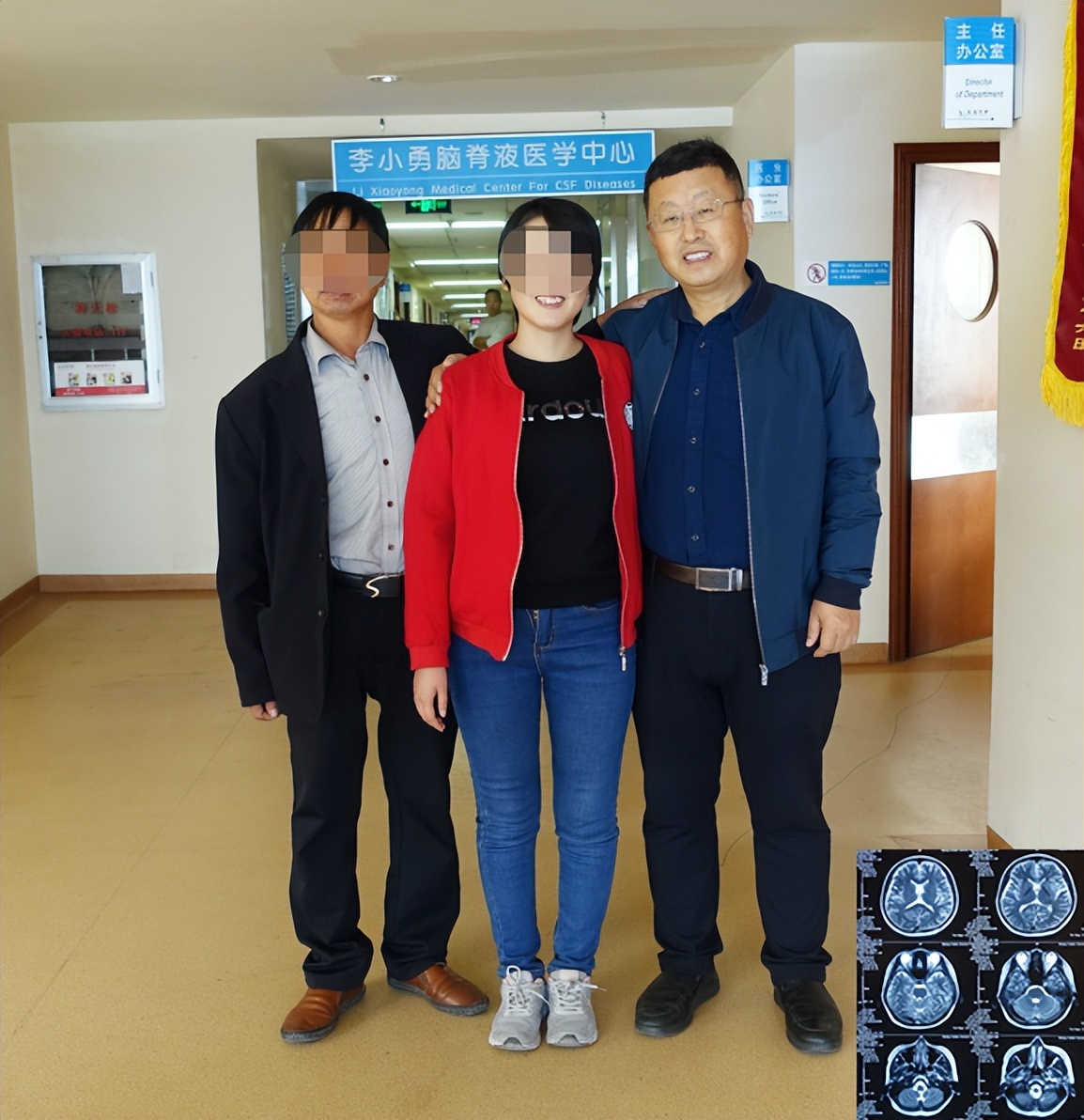 结核性脑积水能治愈吗,儿童结核脑膜炎脑积水