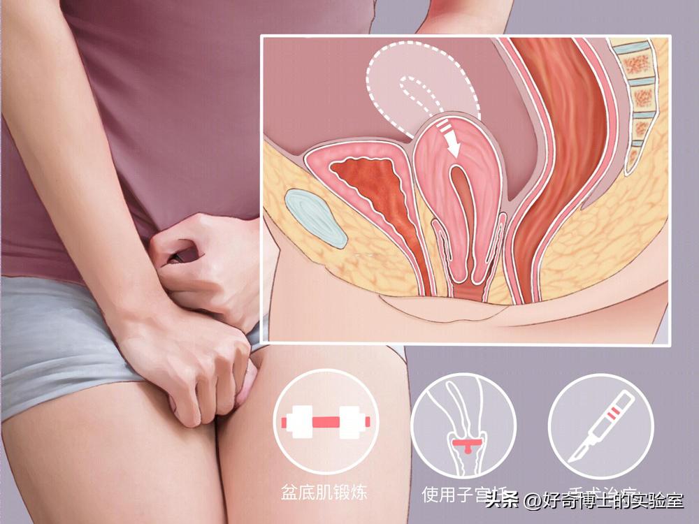 *生活性**时“进不去”怎么办?别担心!这4种方法你一定用得上!