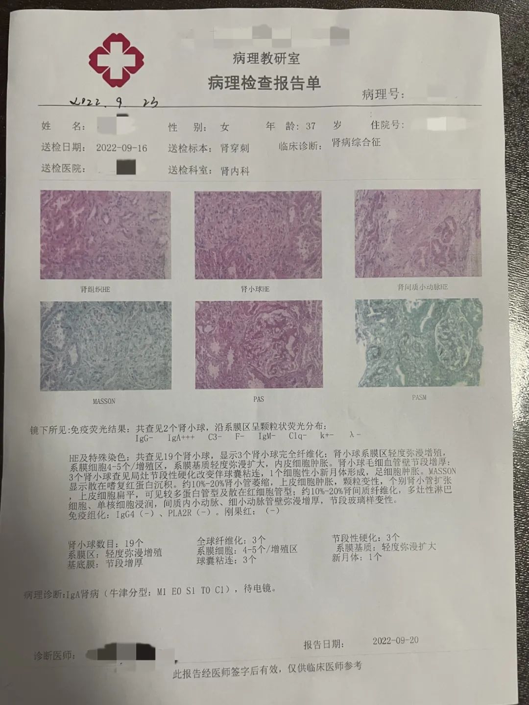 iga肾病的靶向药多少钱,iga肾病20万特药