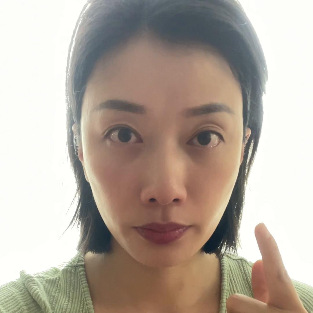 眼肌下垂怎么改善,改善眼部肌肉下垂让眼睛变有神