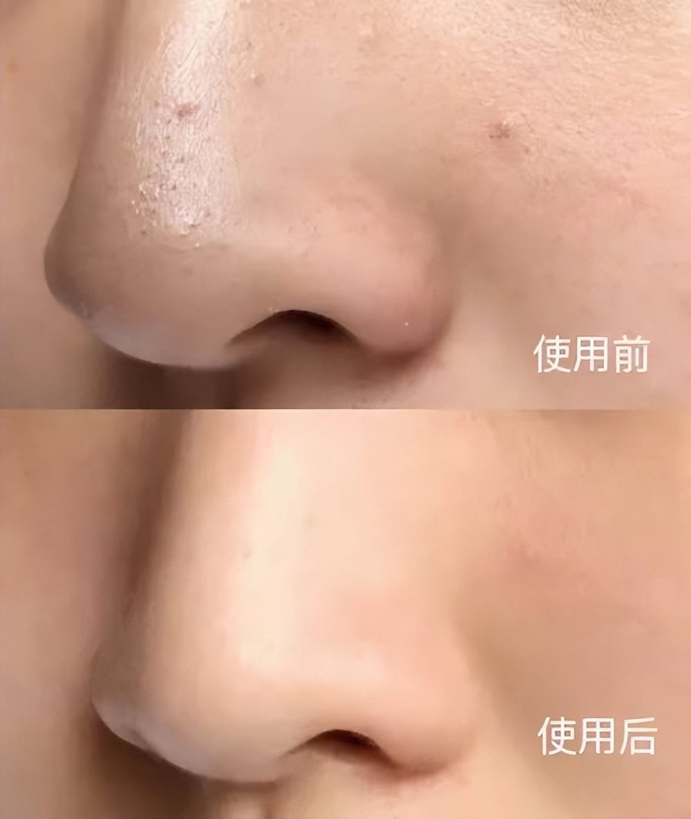 变白神器火山泥真的能洗白吗,火山泥清洁泥膜真的有用吗