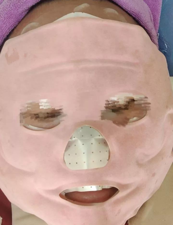 第一次打水光针爆痘,第一次打水光针反黑了