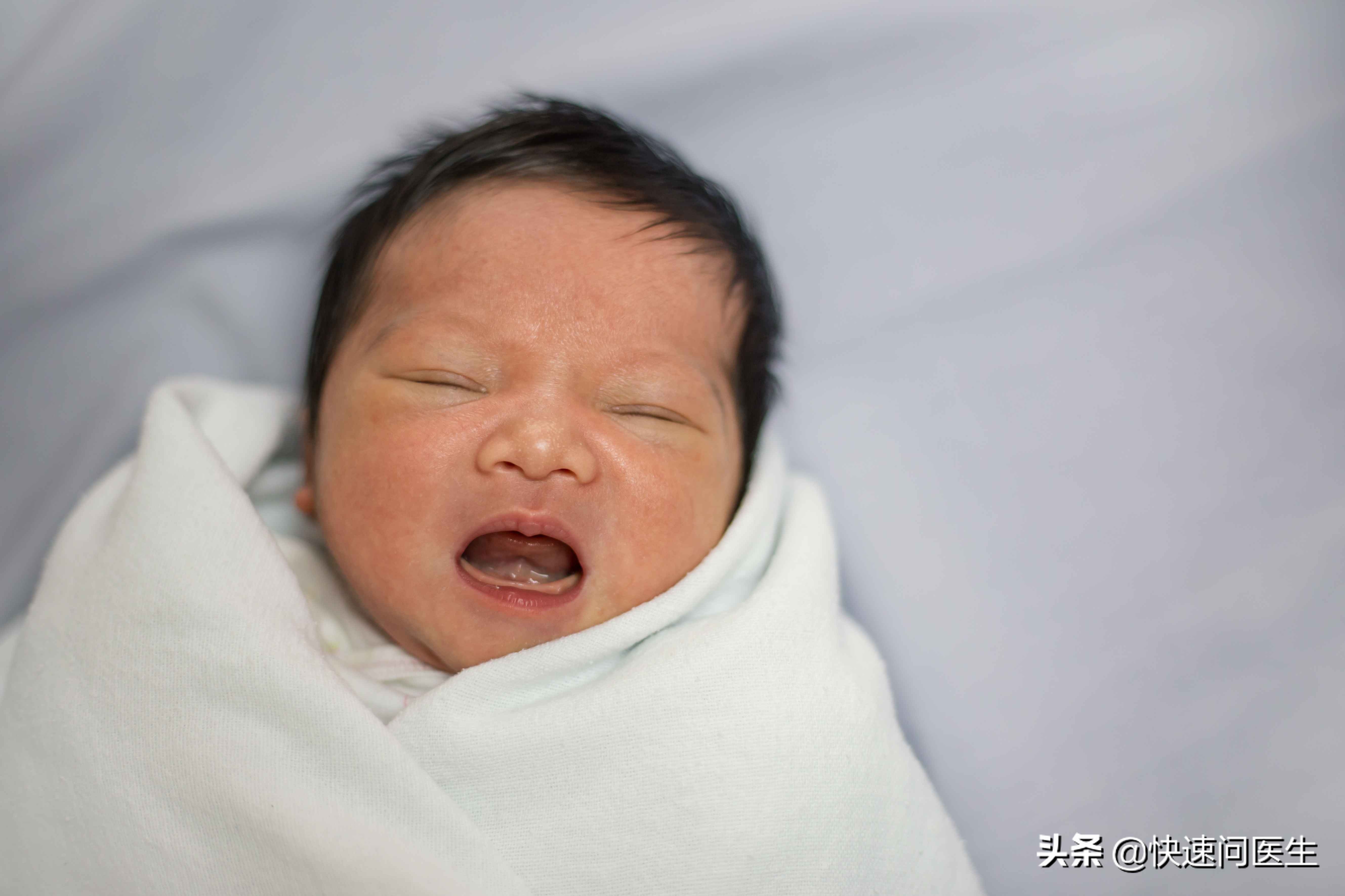 十个月宝宝身上起红疹,宝宝身上起红疹怎么办