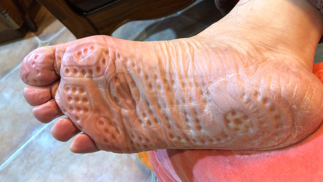 中医足底袜,神奇的按摩袜