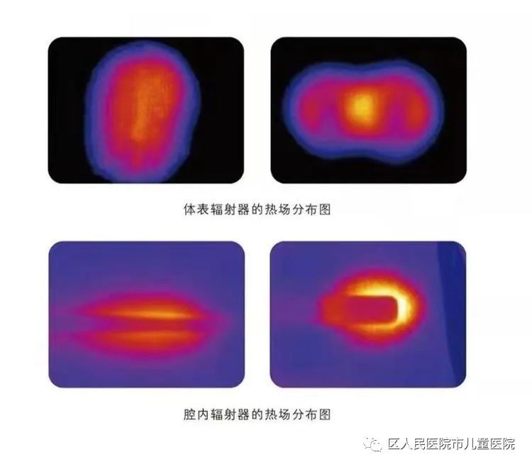 老年病科的新成员——微波治疗仪