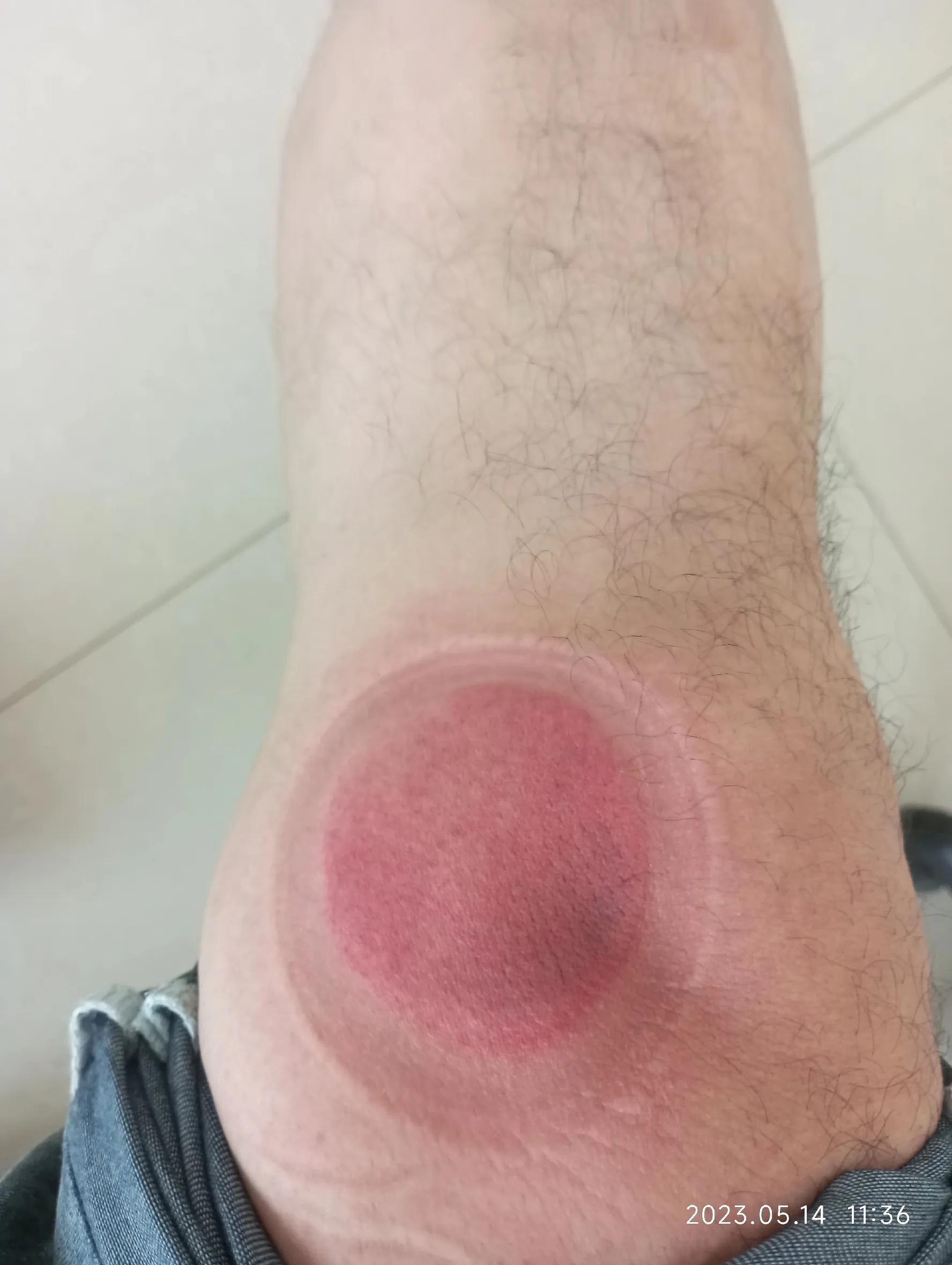 理疗体验店,理疗体验课程流程