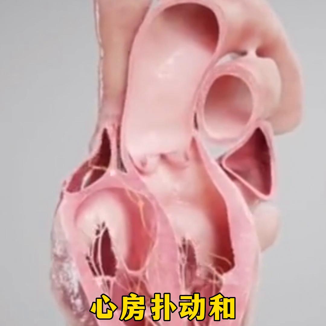 严重的心律失常是怎么造成的,心律失常是什么病严重吗怎么治疗