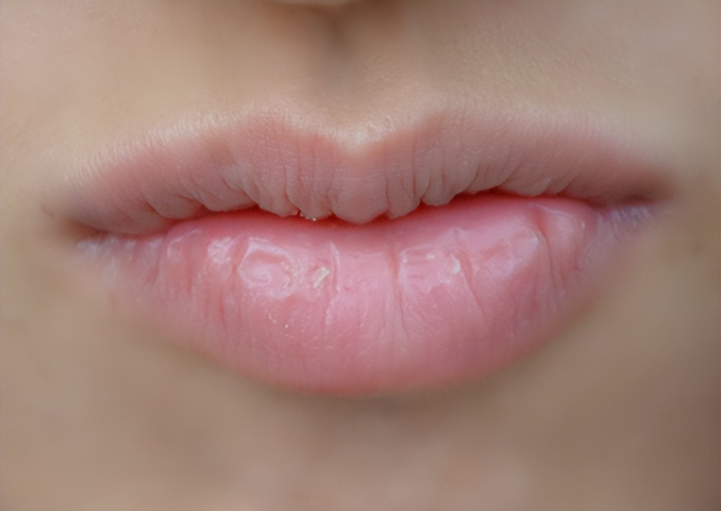 晚上睡觉嘴巴口干缺啥,晚上睡觉嘴巴总发干是真的缺水吗