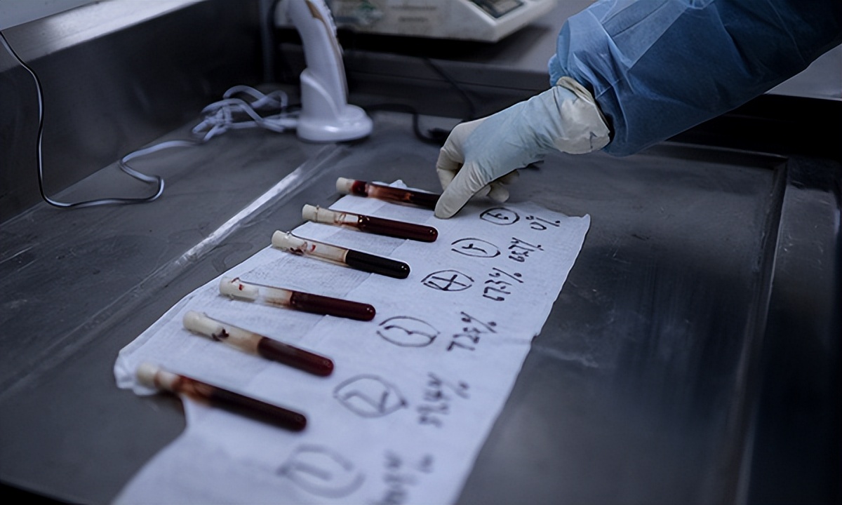 经手3万起案例的DNA鉴定师戴维，揭开内幕：有怀疑对象和狗有染的