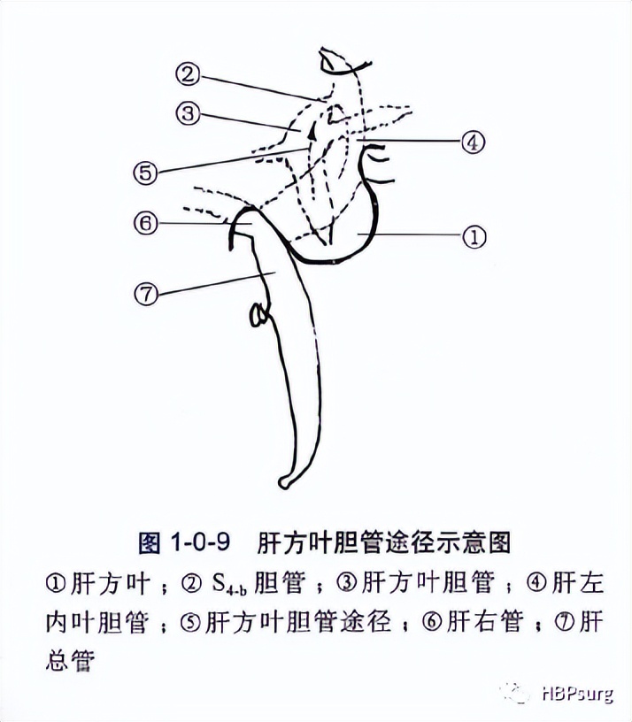关于肝胆管结石治疗的入肝途径的总结