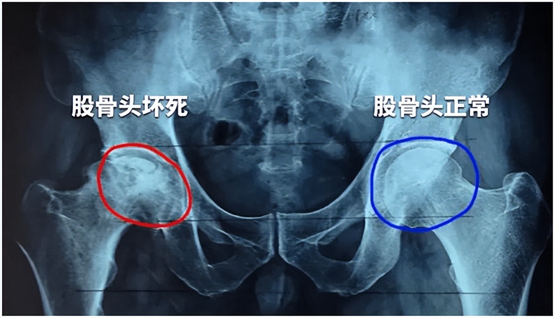 韩立军微县,韩立军照片
