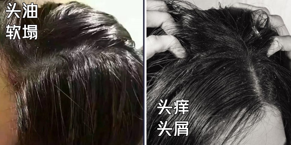 洗发水满婷控油,舒蕾防脱洗发水推荐