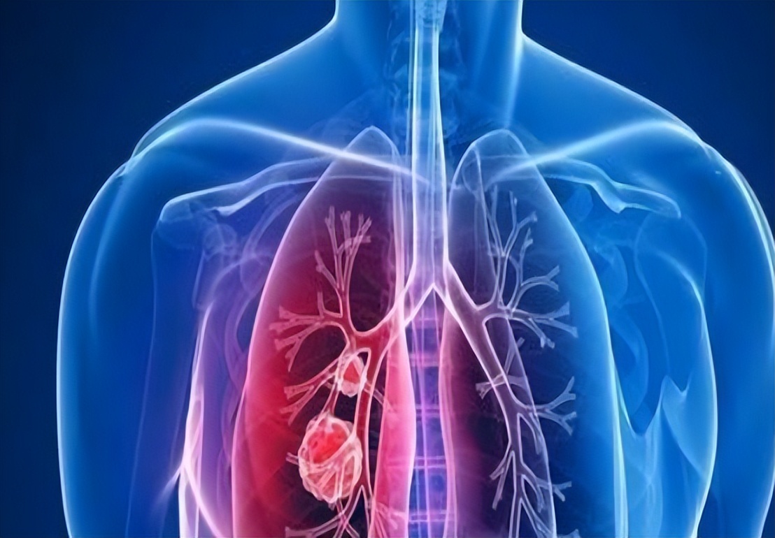 90岁老人去世前有什么征兆,老人即将去世眼睛征兆是什么样的