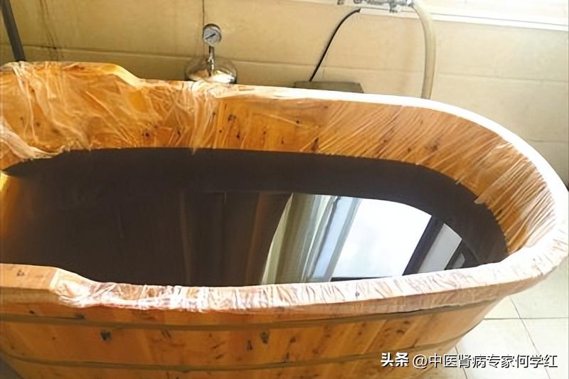 降肌酐最好的方法大全,降肌酐最快最有效的方法