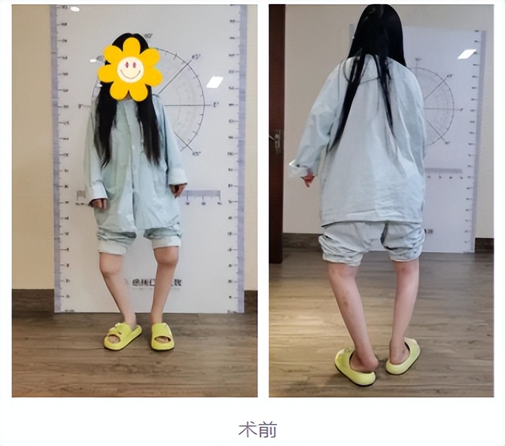 不死的癌症指的是哪种症状,不死的癌症有多可怕